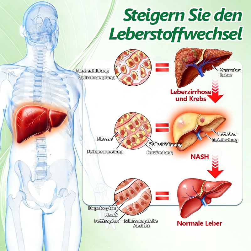 𝗢𝗳𝗳𝗶𝘇𝗶𝗲𝗹𝗹𝗲𝗿 𝗱𝗲𝘂𝘁𝘀𝗰𝗵𝗲𝗿 𝗦𝗵𝗼𝗽 👩‍⚕️ | 𝑴𝑼𝑹𝑾𝑶𝑵® 10-𝑖𝑛-1 𝘽𝙚𝙧𝙗𝙚𝙧𝙞𝙩𝙯𝙚𝙣 𝙉𝙖𝙣𝙤-𝙈𝙞𝙠𝙧𝙤𝙣𝙖𝙙𝙚𝙡-𝙋𝙛𝙡𝙖𝙨𝙩𝙚𝙧 👑 | 𝐔𝐧𝐭𝐞𝐫𝐬𝐭ü𝐭𝐳𝐭 𝐯𝐨𝐧 𝐖𝐢𝐬𝐬𝐞𝐧𝐬𝐜𝐡𝐚𝐟𝐭 | 𝟏𝟎-𝐢𝐧-𝟏 𝐅𝐨𝐫𝐦𝐞𝐥 | 𝐄𝐫𝐠𝐞𝐛𝐧𝐢𝐬𝐬𝐞 𝐢𝐧 𝟕 𝐓𝐚𝐠𝐞𝐧 🌸