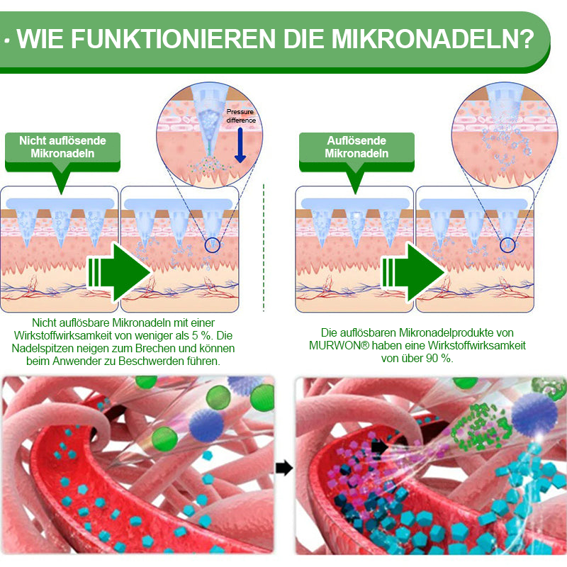 𝗢𝗳𝗳𝗶𝘇𝗶𝗲𝗹𝗹𝗲𝗿 𝗱𝗲𝘂𝘁𝘀𝗰𝗵𝗲𝗿 𝗦𝗵𝗼𝗽 👩‍⚕️ | 𝑴𝑼𝑹𝑾𝑶𝑵® 10-𝑖𝑛-1 𝘽𝙚𝙧𝙗𝙚𝙧𝙞𝙩𝙯𝙚𝙣 𝙉𝙖𝙣𝙤-𝙈𝙞𝙠𝙧𝙤𝙣𝙖𝙙𝙚𝙡-𝙋𝙛𝙡𝙖𝙨𝙩𝙚𝙧 👑 | 𝐔𝐧𝐭𝐞𝐫𝐬𝐭ü𝐭𝐳𝐭 𝐯𝐨𝐧 𝐖𝐢𝐬𝐬𝐞𝐧𝐬𝐜𝐡𝐚𝐟𝐭 | 𝟏𝟎-𝐢𝐧-𝟏 𝐅𝐨𝐫𝐦𝐞𝐥 | 𝐄𝐫𝐠𝐞𝐛𝐧𝐢𝐬𝐬𝐞 𝐢𝐧 𝟕 𝐓𝐚𝐠𝐞𝐧 🌸